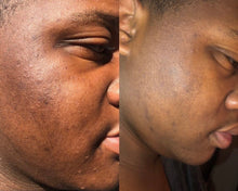 Load image into Gallery viewer, Aurum Facial Serum