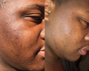 Aurum Facial Serum