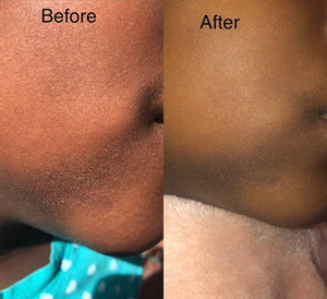 Aurum Facial Serum