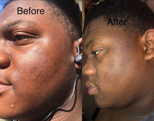 Aurum Facial Serum